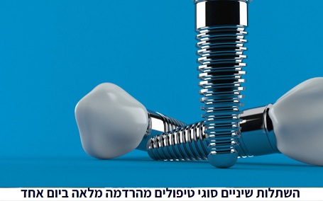 מה זה השתלות שיניים מה חשוב לדעת